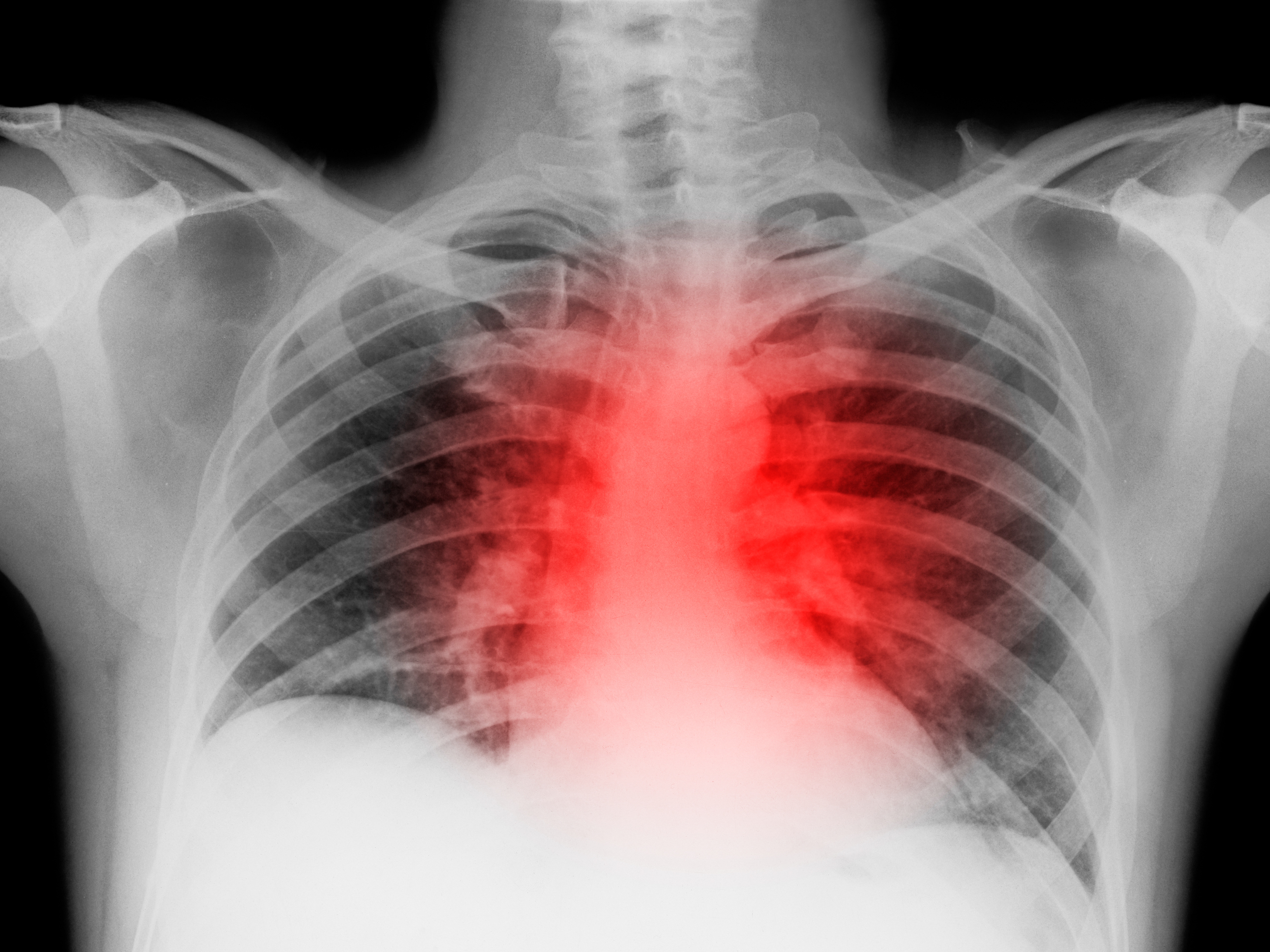 For some patients, cardiovascular problems persist long after COVID - Vimarsana News